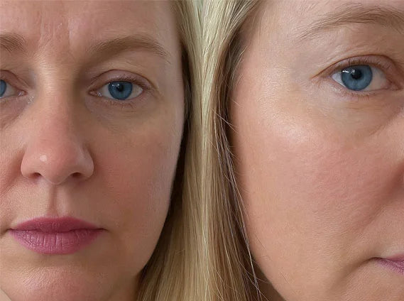 Customer before and after results