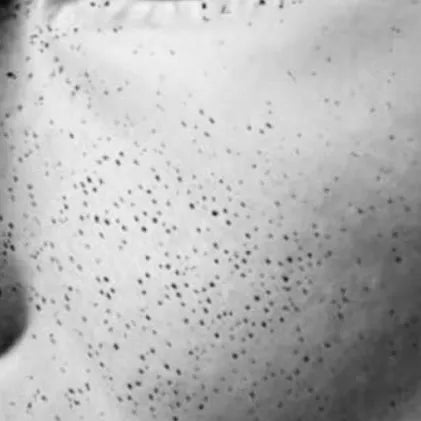 Close-up skin image before using Punctual