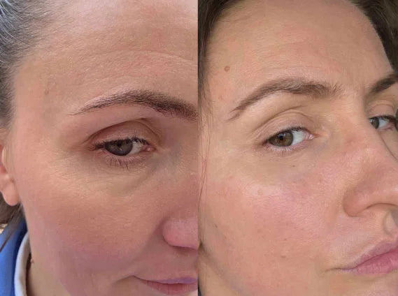Customer before and after results